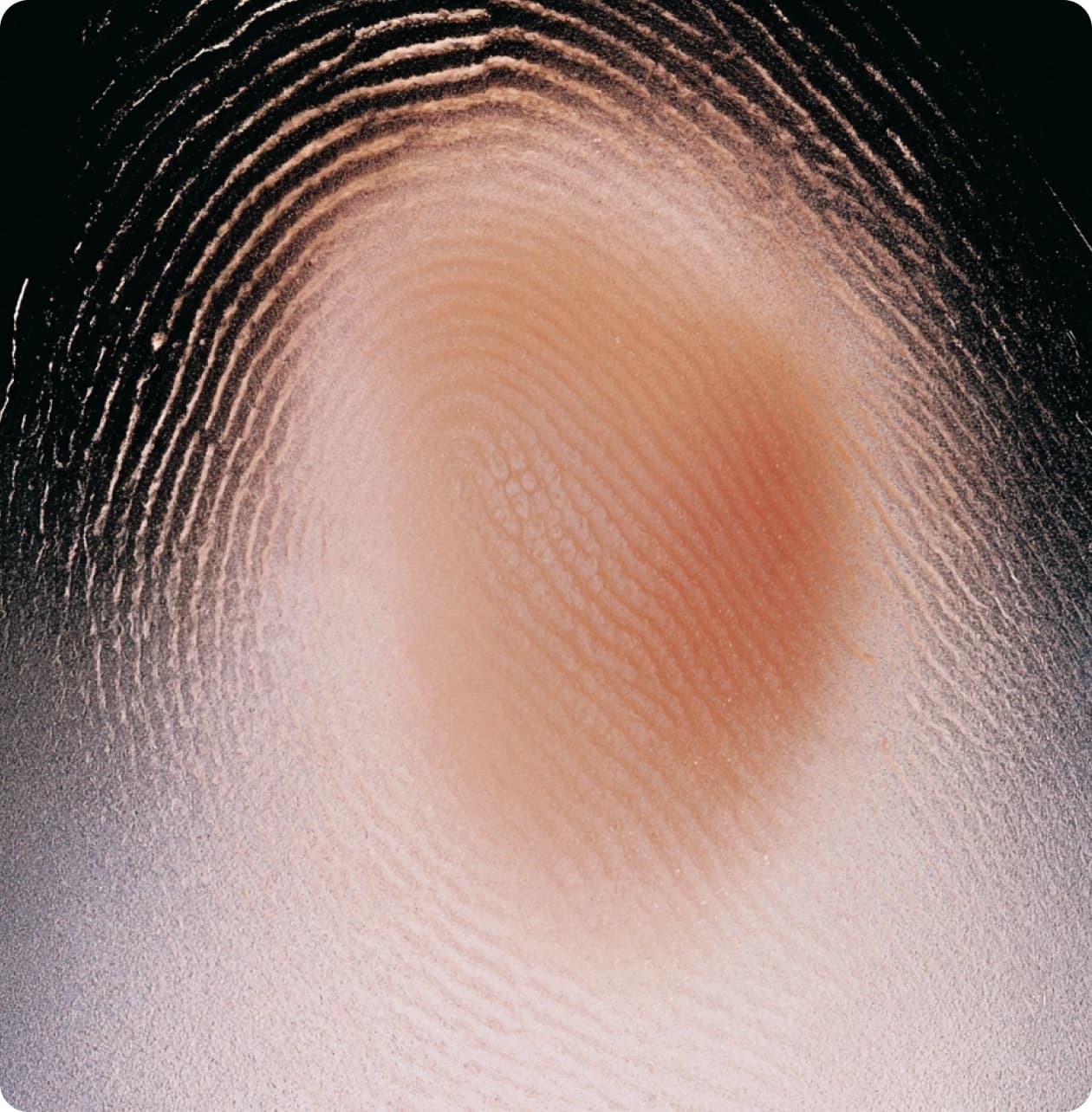 Macro photograph of skin ridges, lit like a fingerprint